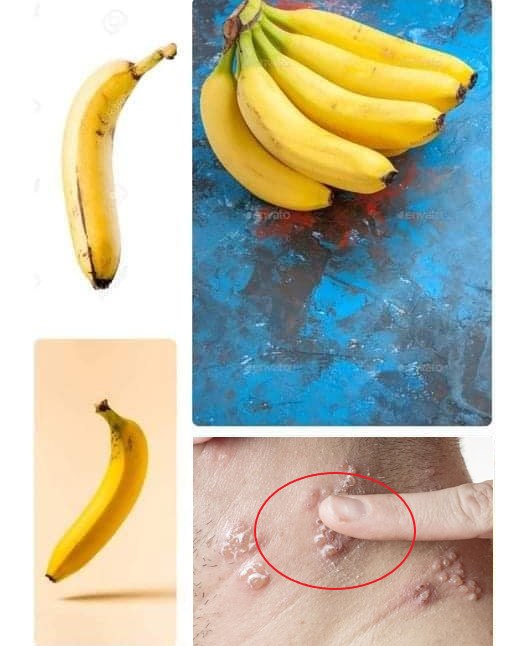 See What Happens To Your Body If You Eat Bananas Every Day TOP News US